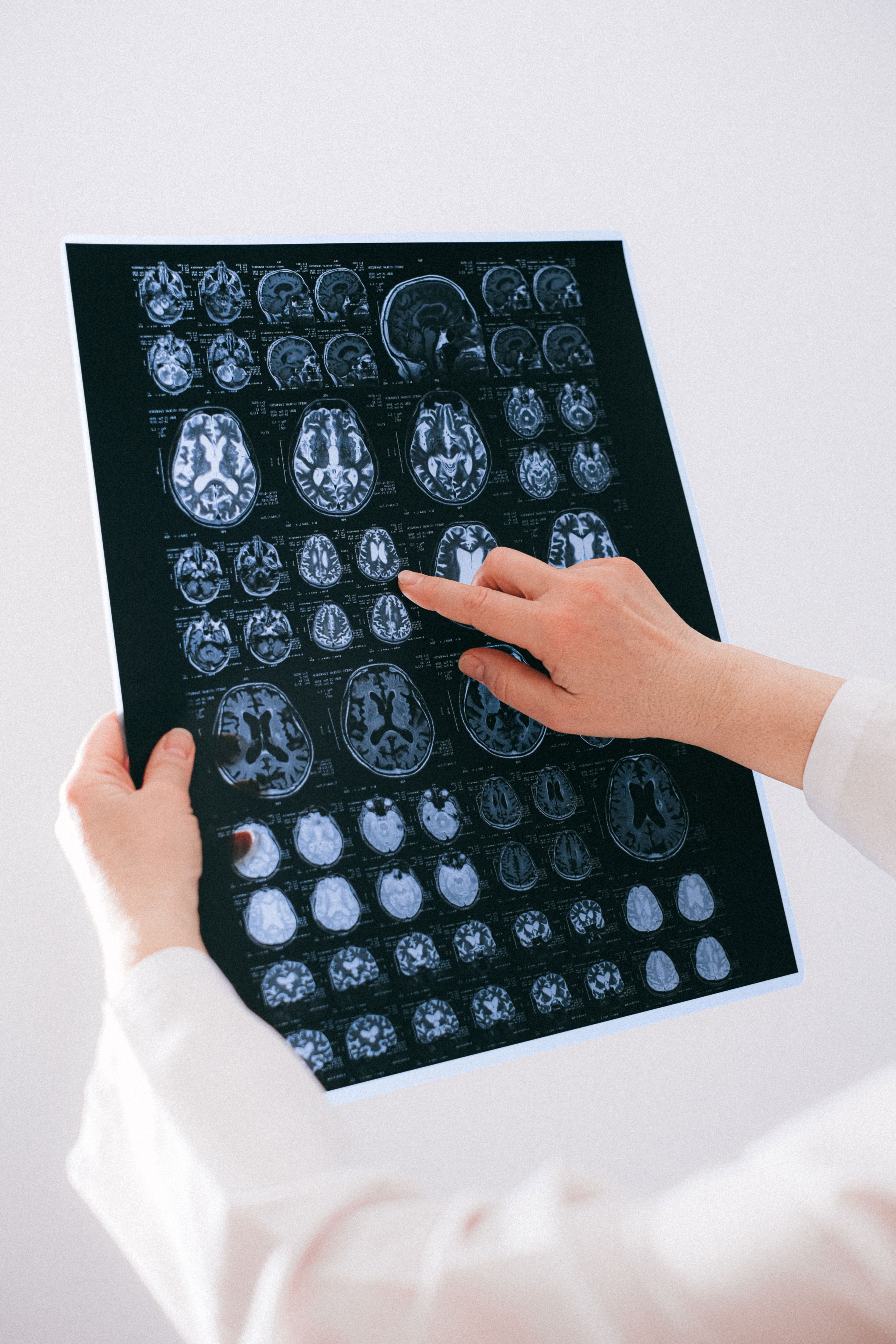 Comprehensive evaluation of a patient experiencing memory disorders