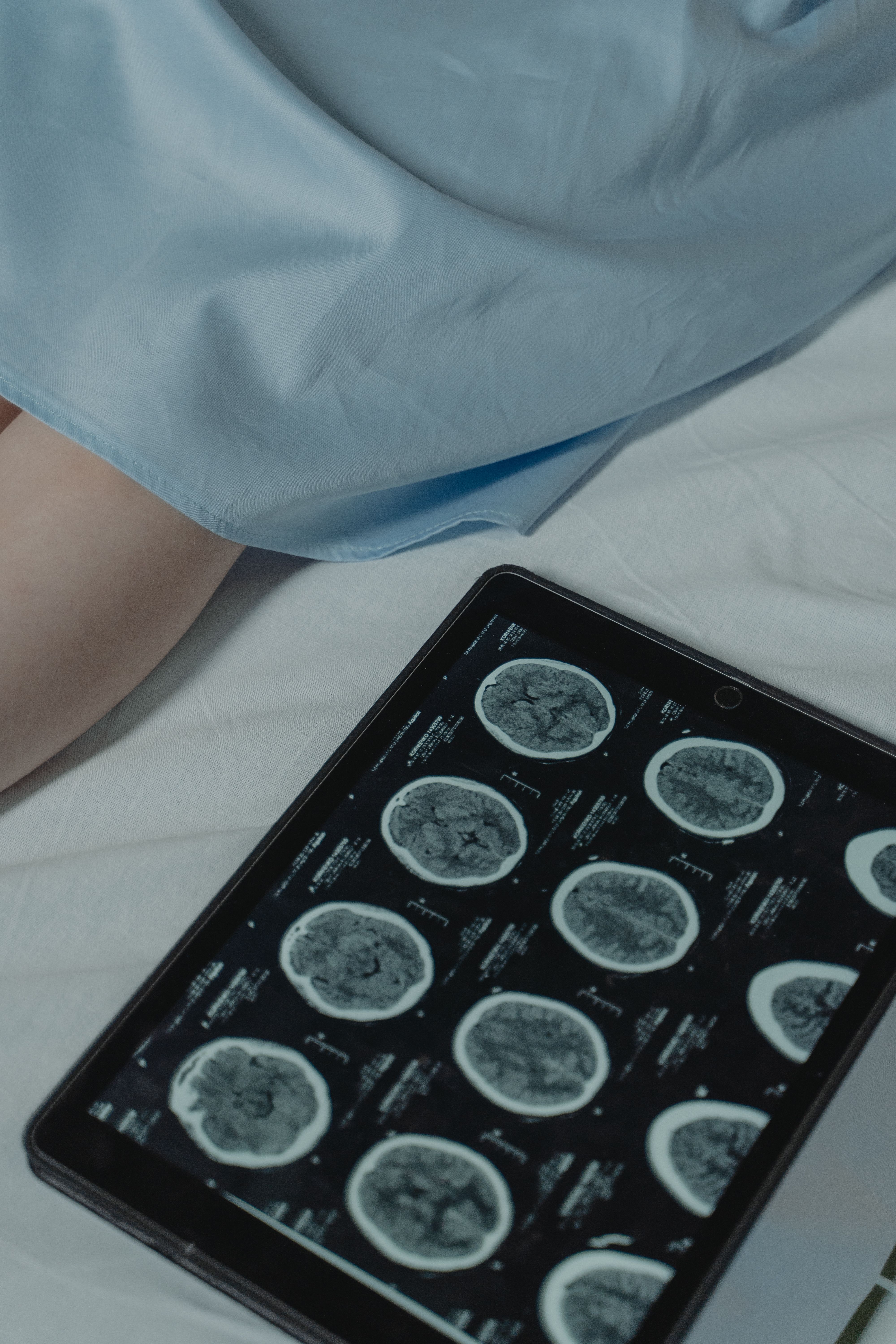 Neurologist examining a patient during a consultation